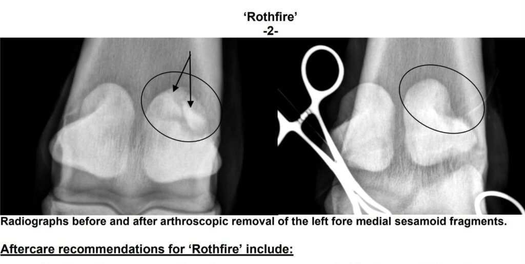 X-ray revealing Rothfire's injury