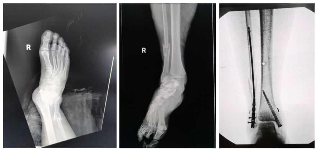 Umberto Rispoli x-rays